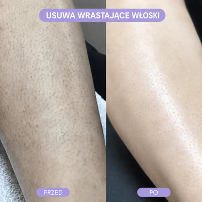 Depilator z kryształkami Zolven Bleame