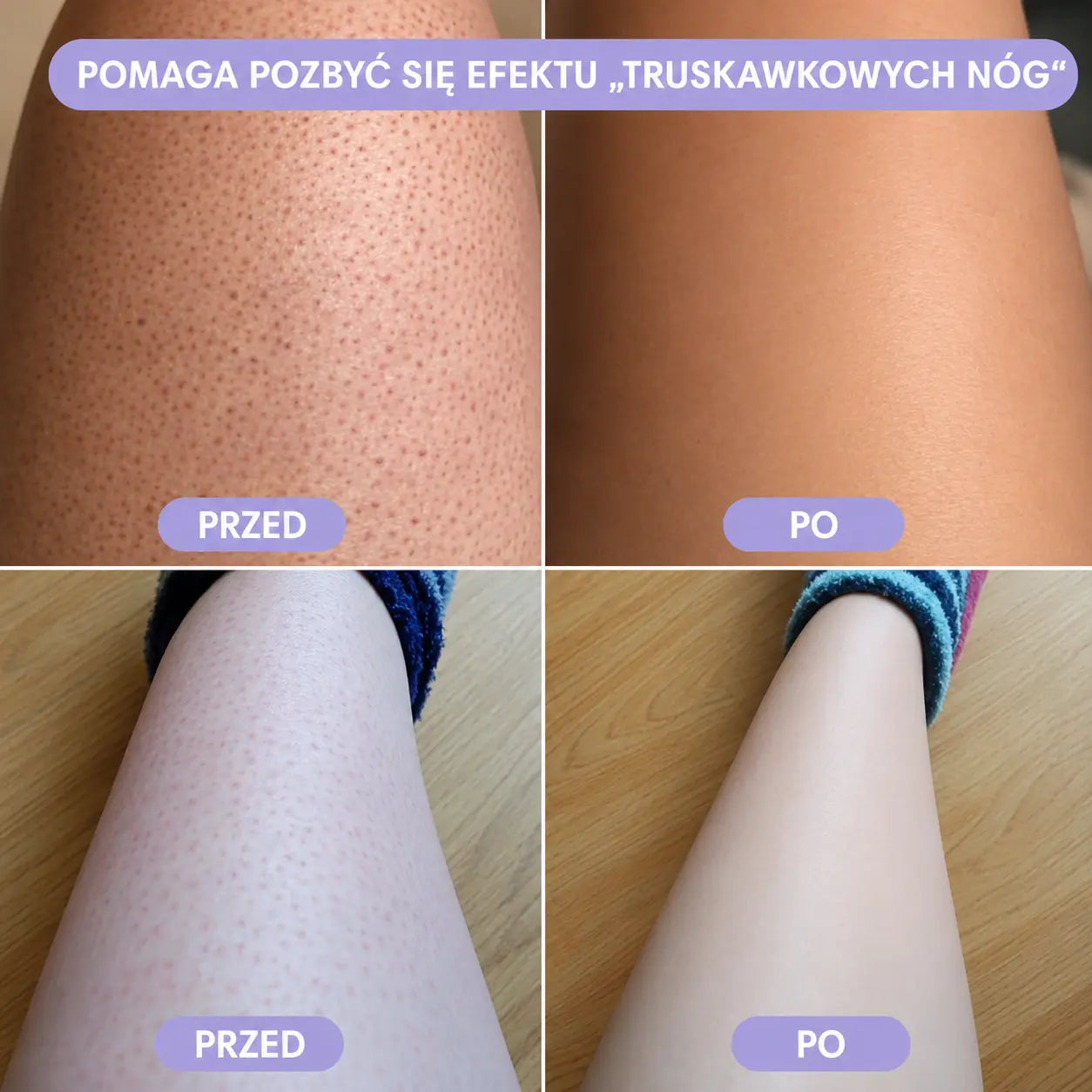 Depilator z kryształkami Zolven Bleame